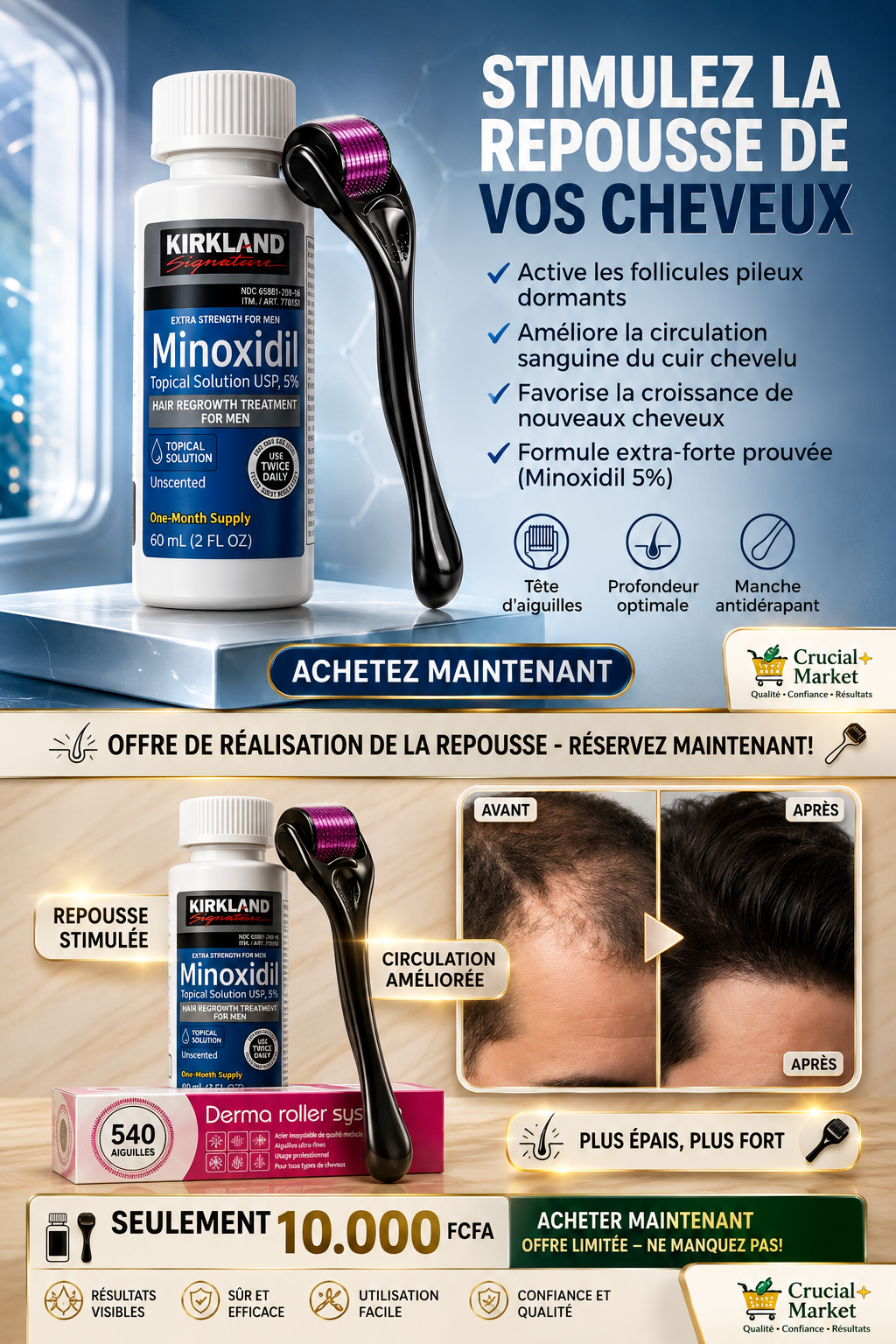 Flacon Kirkland Minoxidil 5% et Derma Roller Crucial+ Market